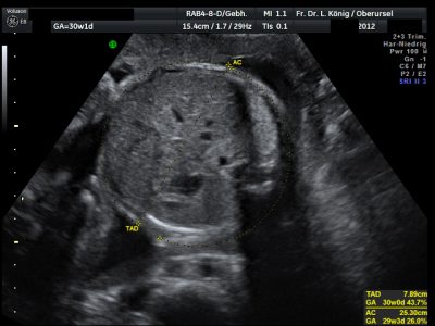 Imaging of the fetal abdomen (belly).